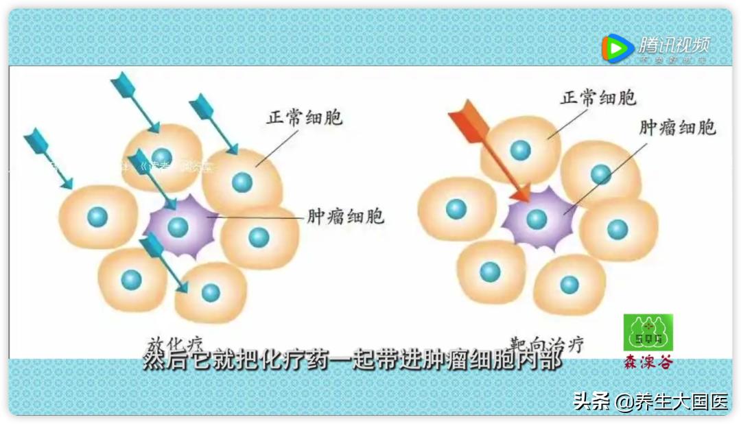 乳腺癌有救吗,乳腺癌治愈的可能性有多大