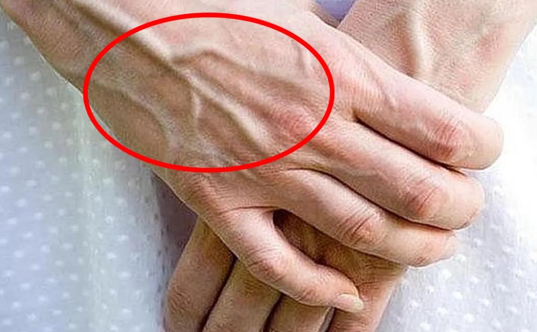 手臂爆青筋是天生的吗,为什么有的人手臂的青筋特别明显