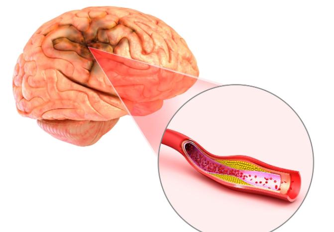 中老年人体检应该检查哪些项目,中老年人一年体检都检查什么