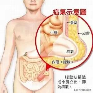 上海岳阳医院疝气专家,岳阳市哪里有治疗疑难杂症的中医