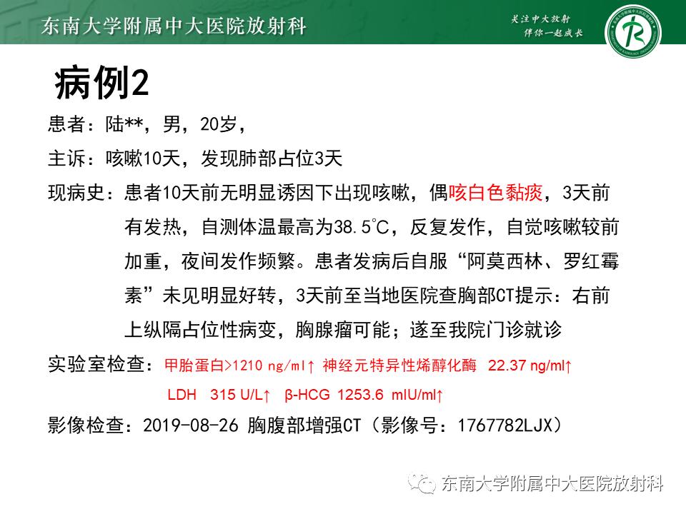 好文分享值得深思,纵隔精原细胞瘤