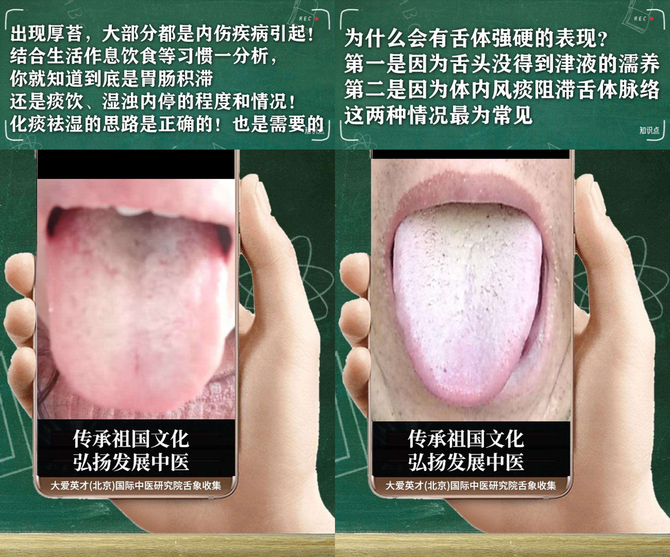 腰膝酸软中医辨证论治,中医腰膝酸软