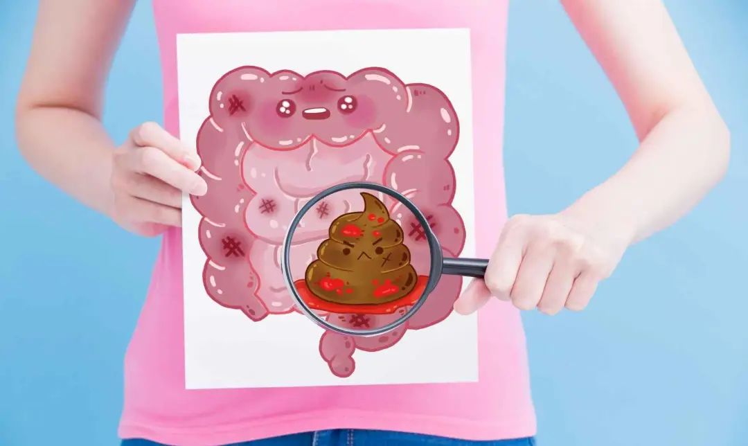 直肠癌放疗期间便血正常吗,直肠癌放疗会引起小便疼痛出血