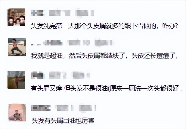 头皮发痒有头屑是什么原因,头皮发痒头屑多的原因和解决方法