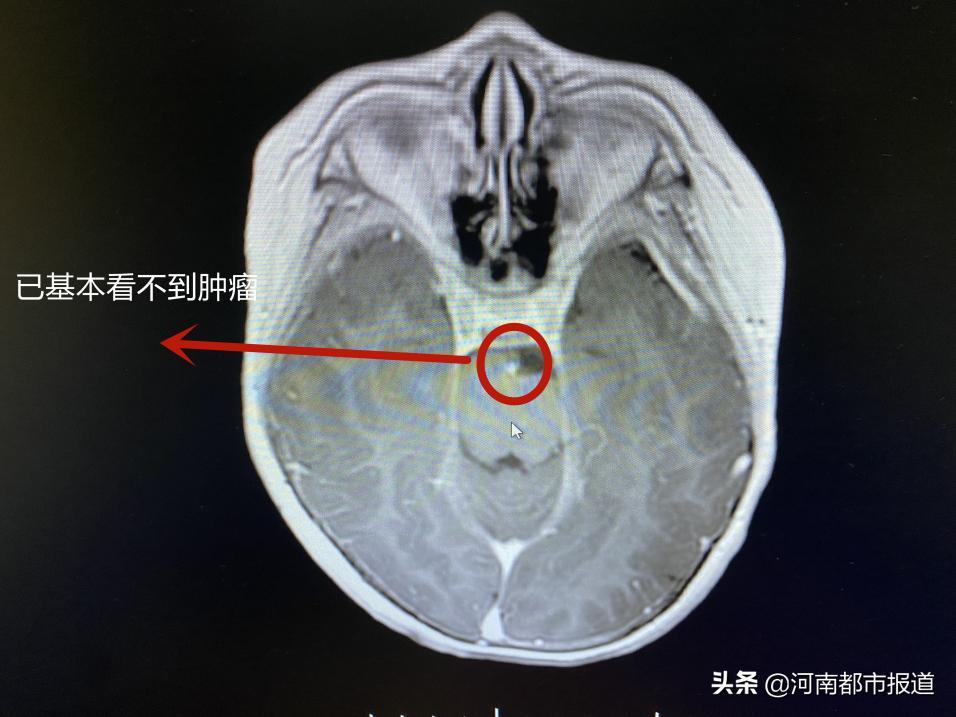 晴天霹雳神童,晴天霹雳儿童