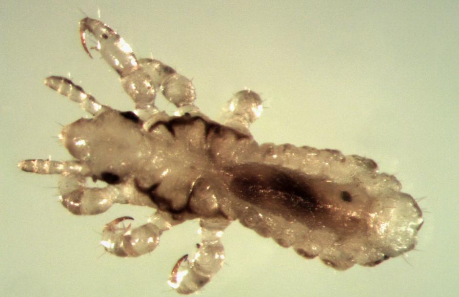 工厂打工爱上了大18岁大叔，确定后次日下身瘙痒难耐，原来是阴虱