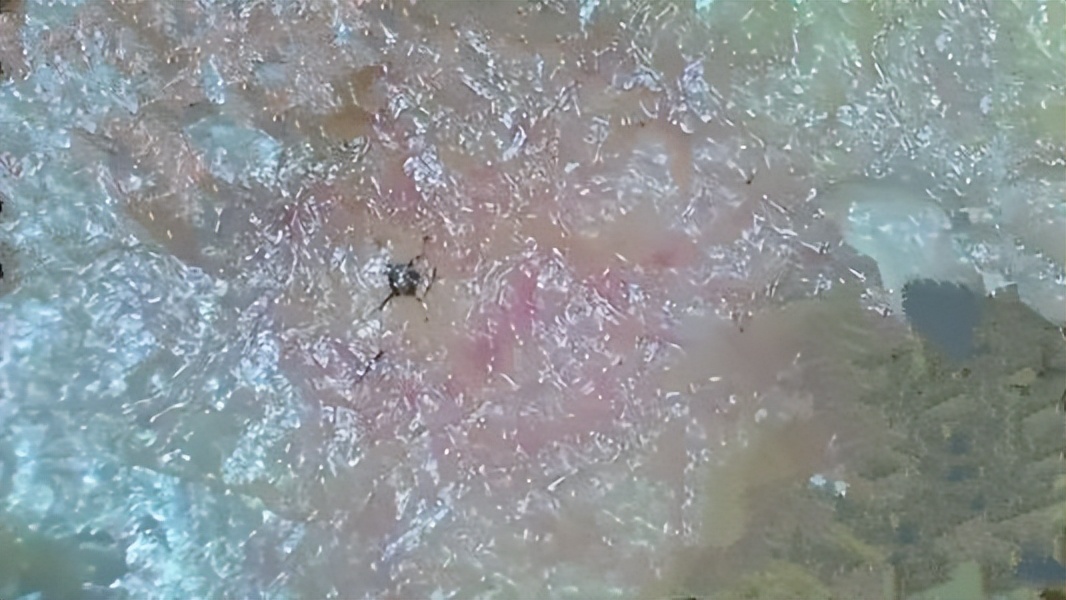 脸上起皮了是怎么回事,脸上起皮是什么原因怎么办