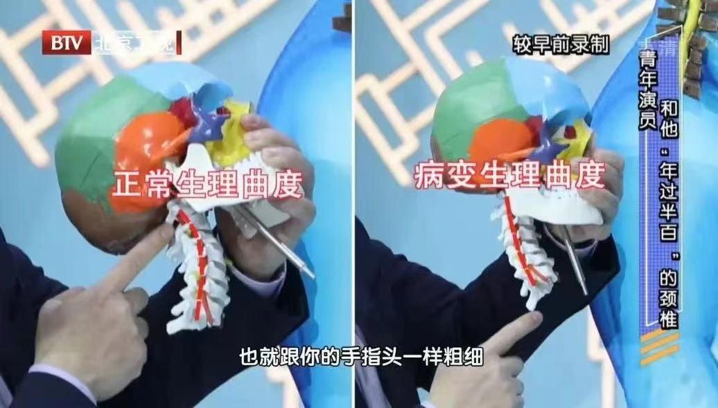 头痛的“元凶”终于找到了！痛在哪里，病因在哪儿？一文都告知你