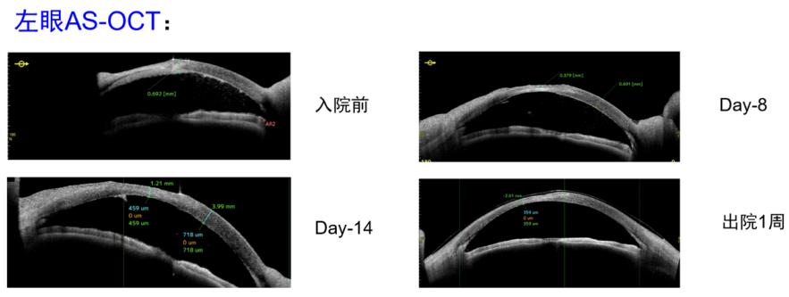 鐪肩鍖荤敓鍐簯,鍖楀尰涓夐櫌鐪肩涓撳鍐簯