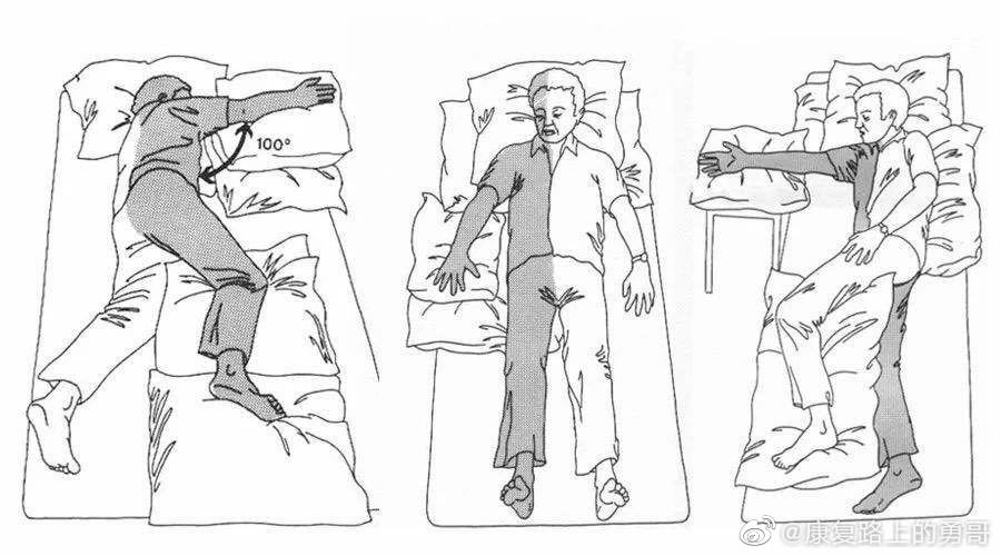 偏瘫患者肩部半脱位疼痛,偏瘫患者肩膀疼痛怎么缓解