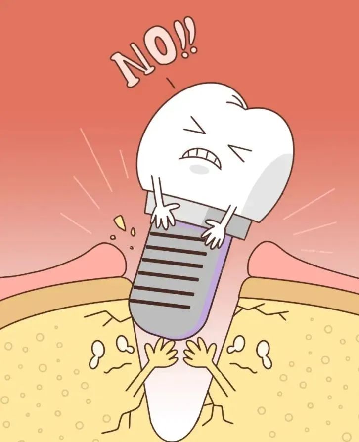 奥齿泰种植牙能用多久,种植牙多久可以抽烟