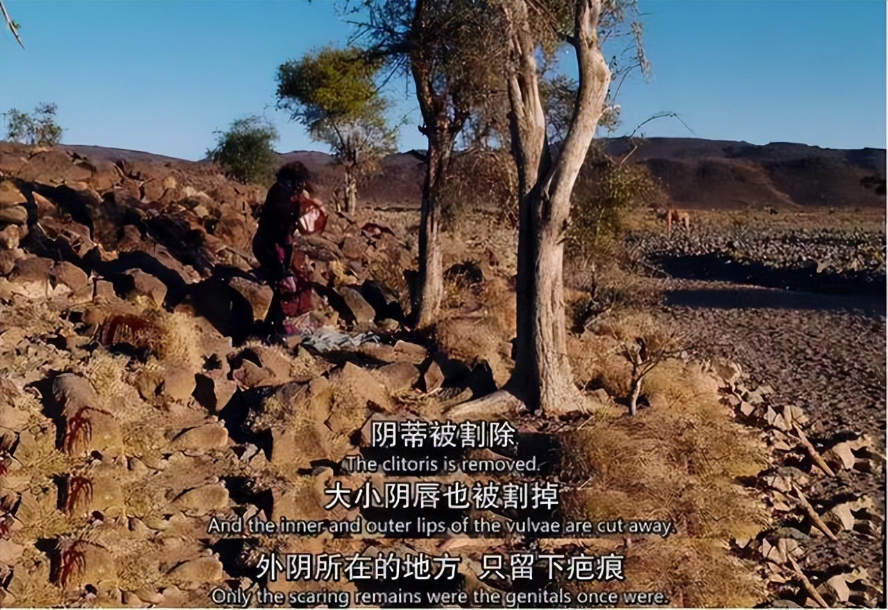 切除器官的女人,切除子宫对女性身体的伤害