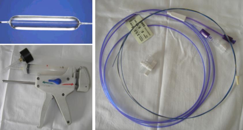 咯血一定要做支气管镜吗,支气管镜的注意事项
