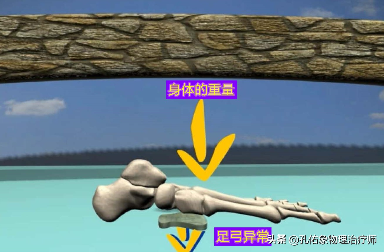 中老年人脚底痛是什么原因,老人脚底板好疼是什么原因