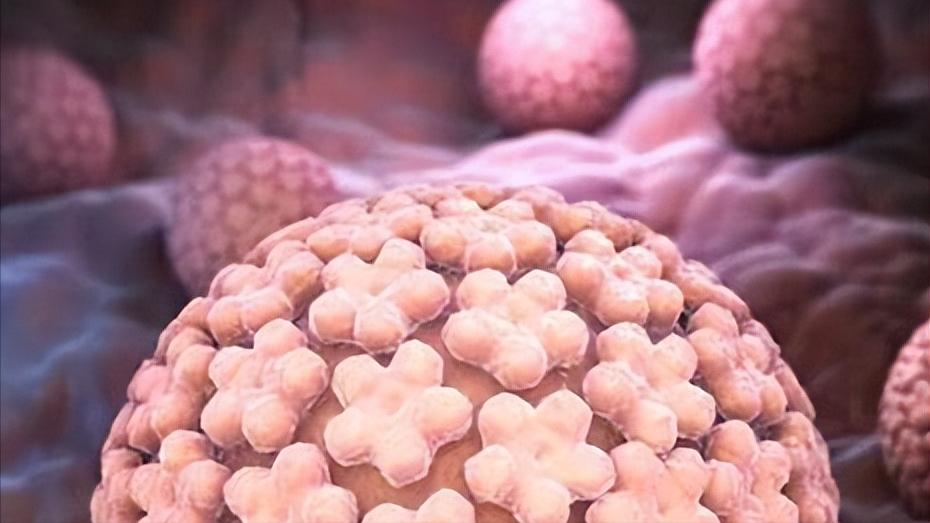 妇科检查出HPV阳性,该怎么办?一定需要治疗吗?