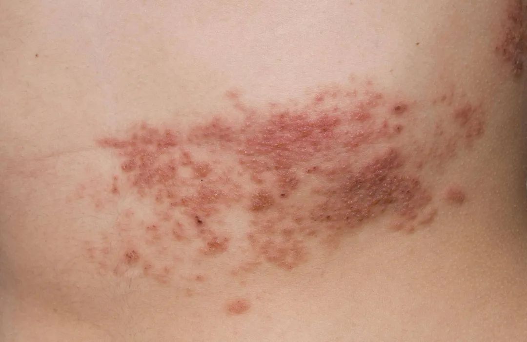 栖霞大伯腰盘长龙