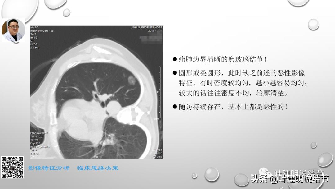 在《一脉阳光》呼吸影像诊断专题培训班上的讲课PPT（第一部分）