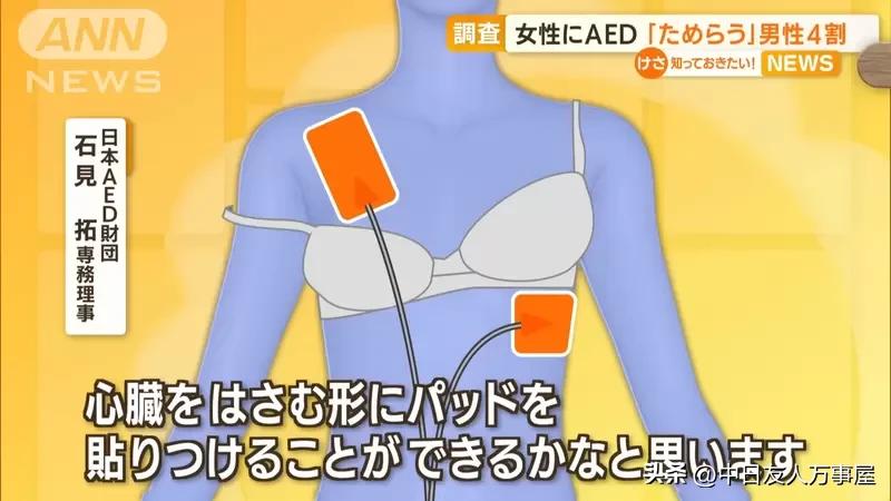 男性不敢对女性施以AED急救问题，救人的时候有顾虑