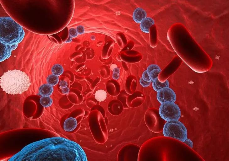 菌血症怎么治才能除根,菌血症最新治疗方法