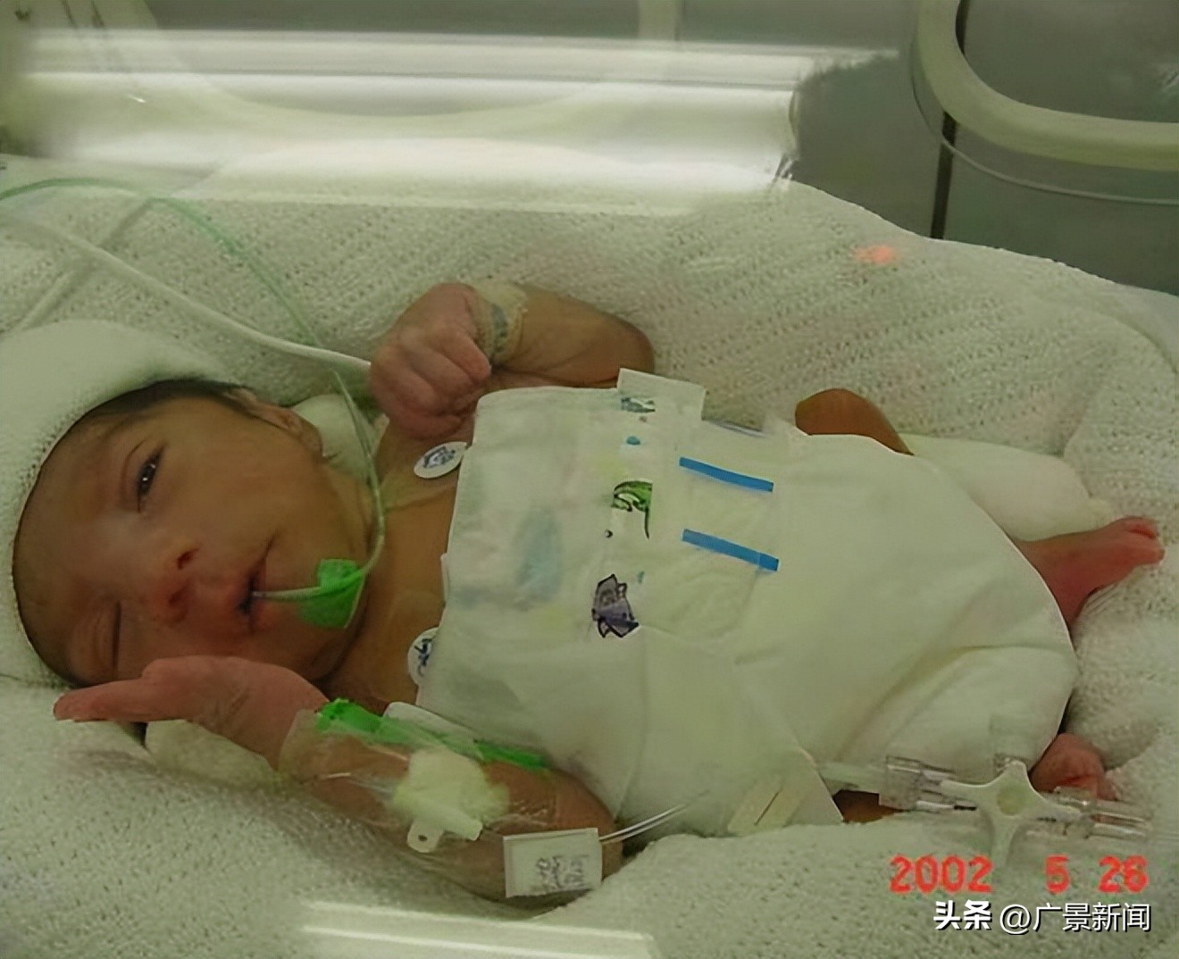 只有半个身子的男人,只有半个身子的人