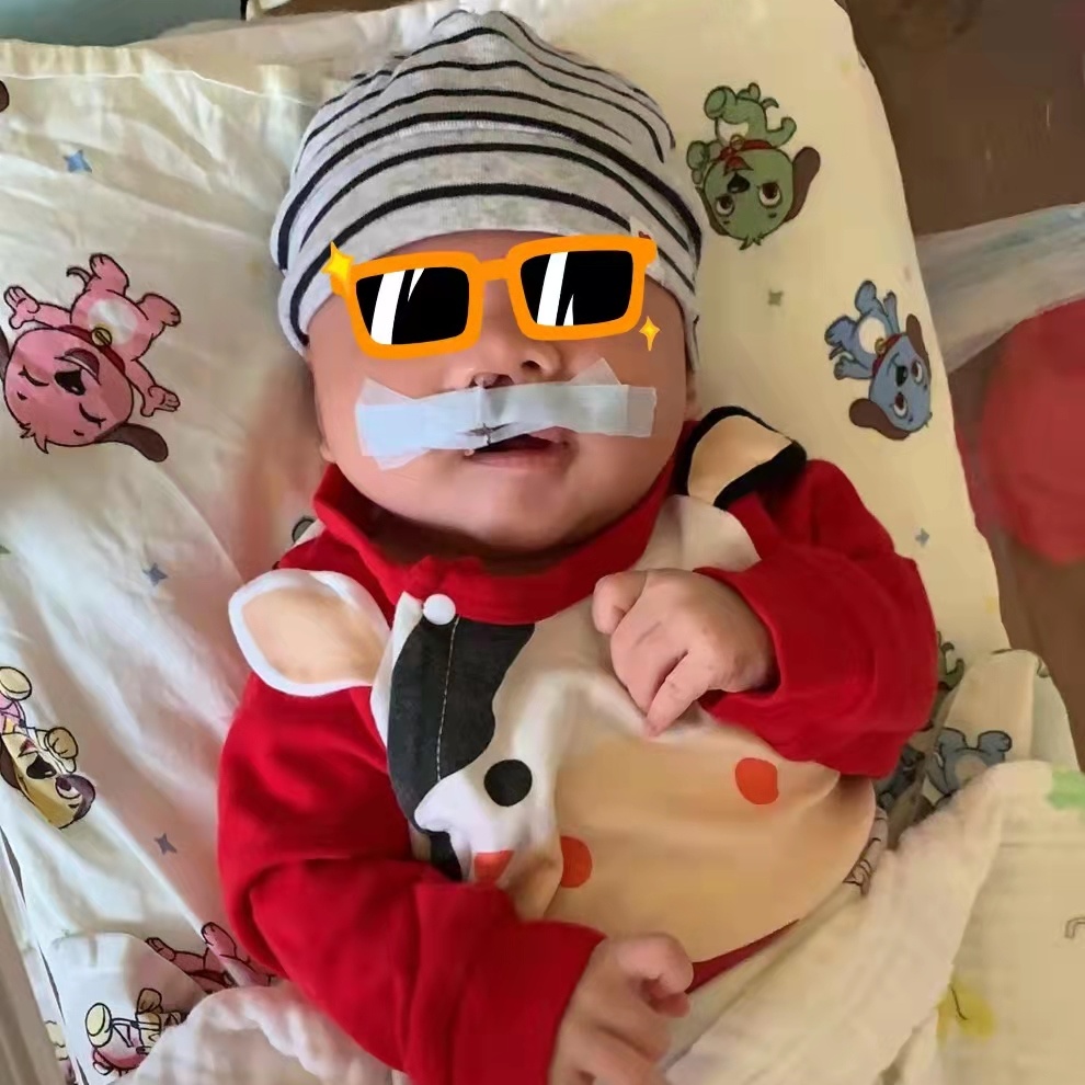 宝宝是一只“小兔子”，还没长牙就要开始正畸了