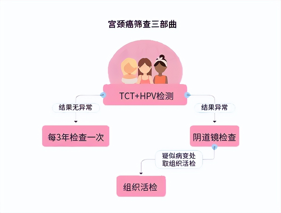 女性须知：阴道镜真的很可怕吗？