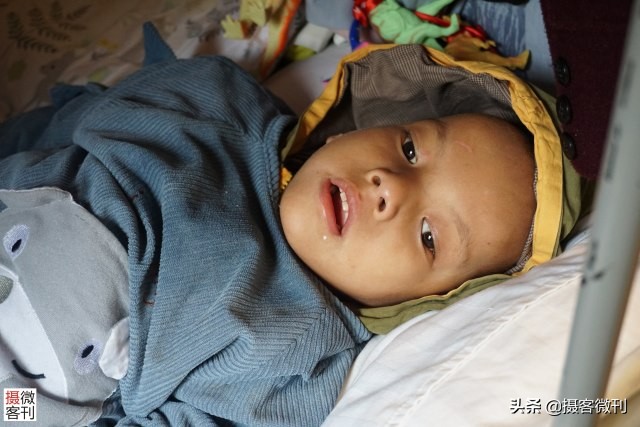 男童重病垂危妈妈哭,两岁男童罹患怪病