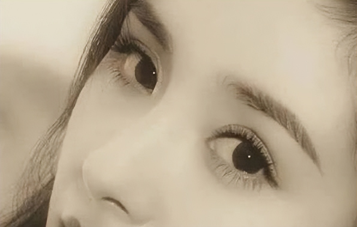 全切双眼皮开眼角7天内注意事项,三点一线双眼皮开眼角后注意事项