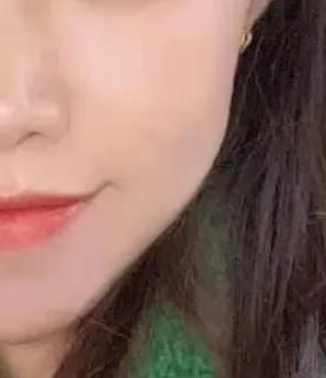 去医院美容科看皮肤靠谱吗,毁容美容