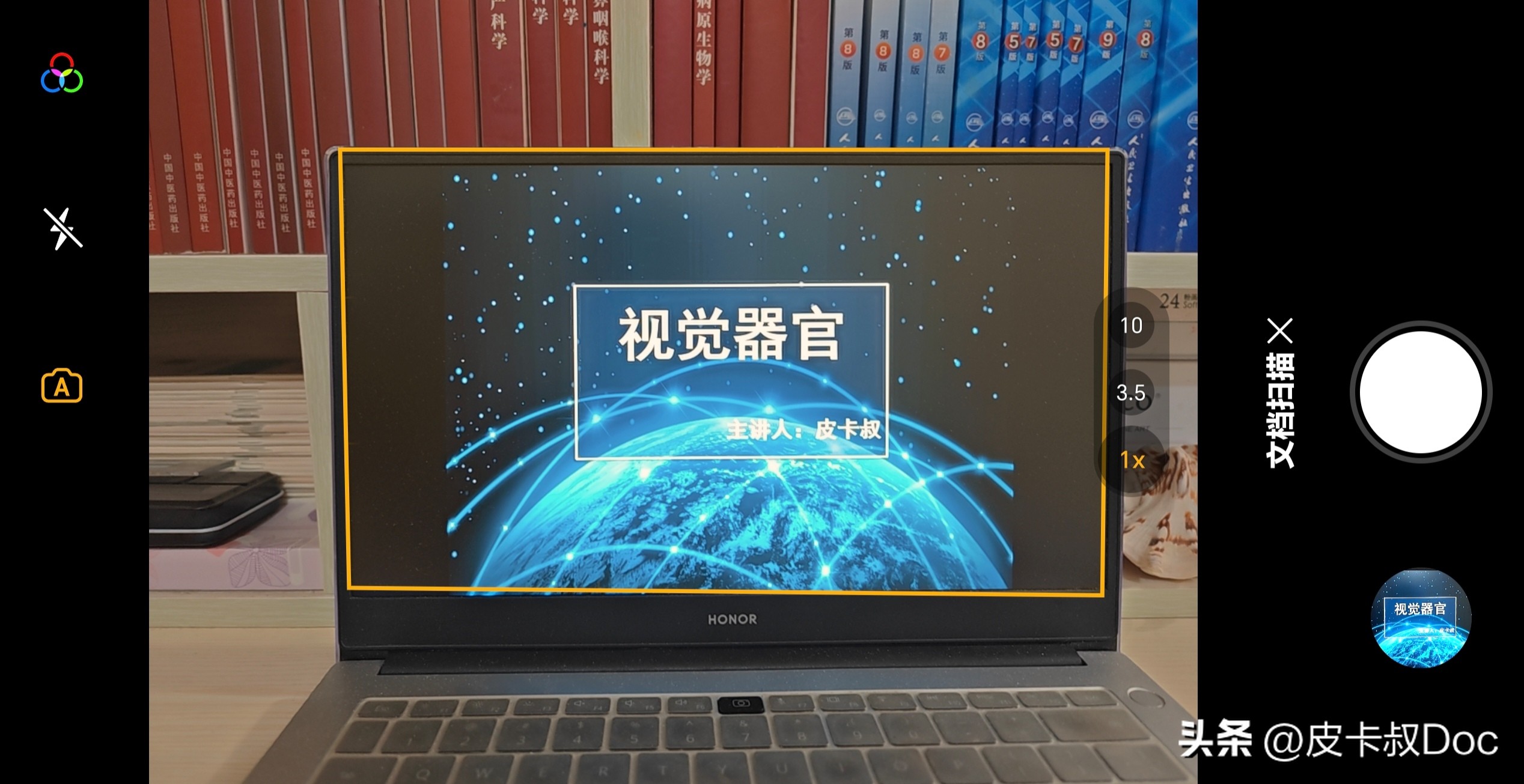 不吹不黑荣耀magic5pro使用感受,荣耀magic5pro手机性能排行榜