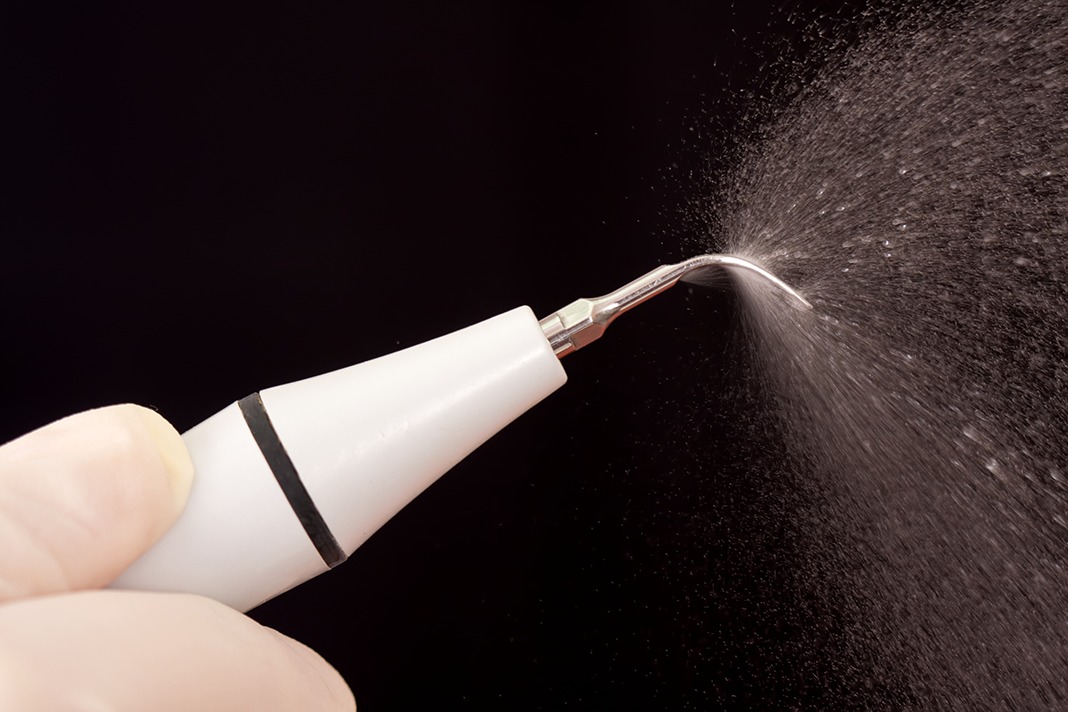 洗牙之后疼怎么办,洗牙疼不疼视频大全