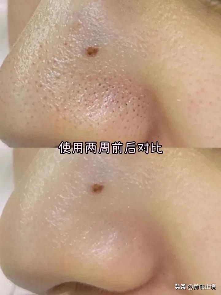 控油美白洗面奶推荐男士真实测评,男士洗面奶控油去螨排行榜前十名