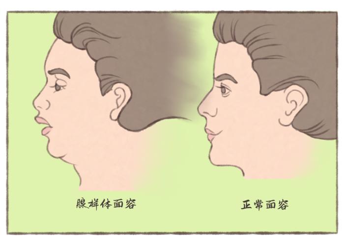 鼻炎腺样体问题去什么科室检查,鼻炎腺样体看什么科