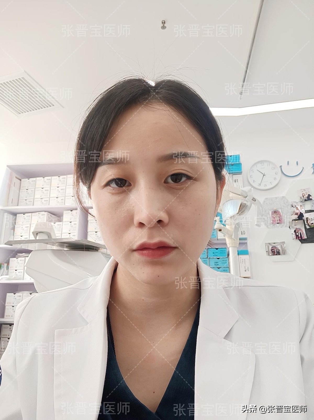 去眼袋手术后期变老,去眼袋手术的真实感受