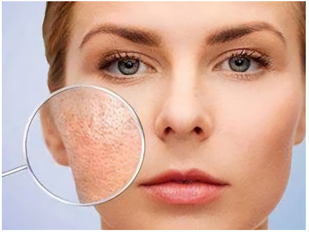 毛孔粗大如何改善治愈系,解决毛孔粗大最有效的方法医美