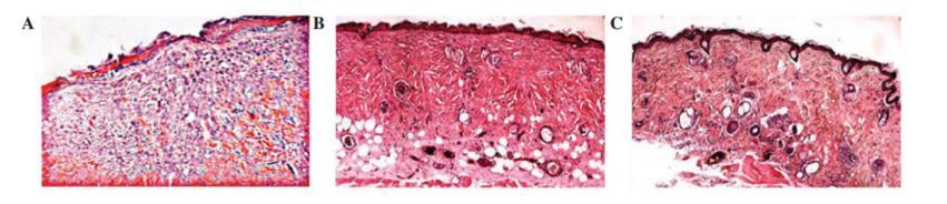 ccs积雪草油橄榄精华测评 (积雪草软膏能和橄榄油一起用)