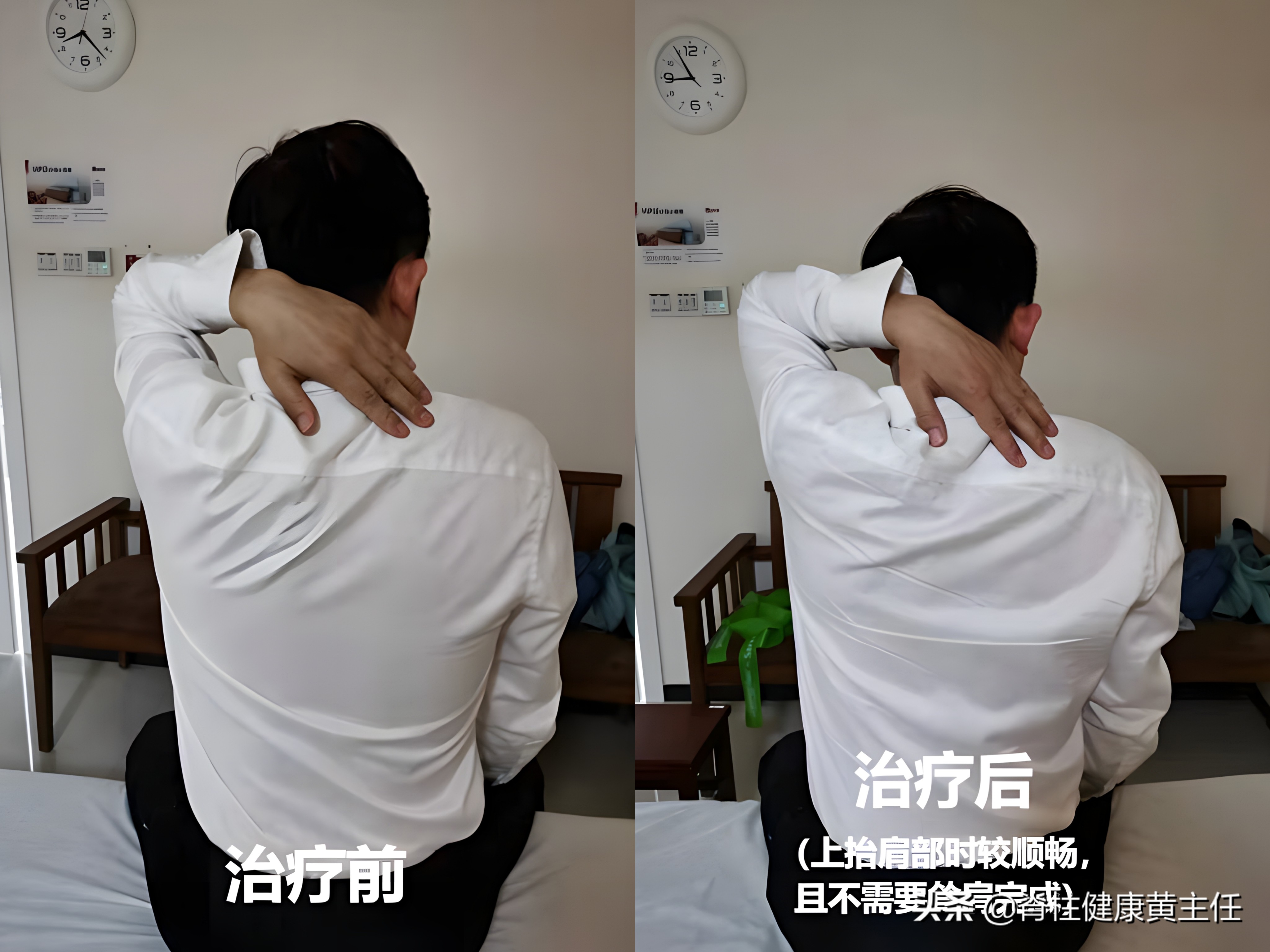 肩关节疼痛护理诊断及措施,肩关节疼痛如何查体