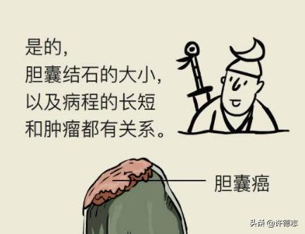 40岁女人胆囊息肉消失案例,关于胆囊息肉的视频