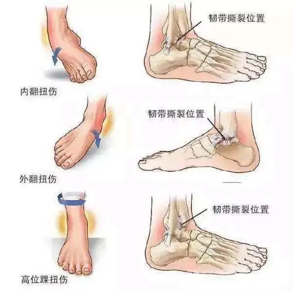 冬奥会自我防护,冬奥会中项目规则和安全要领