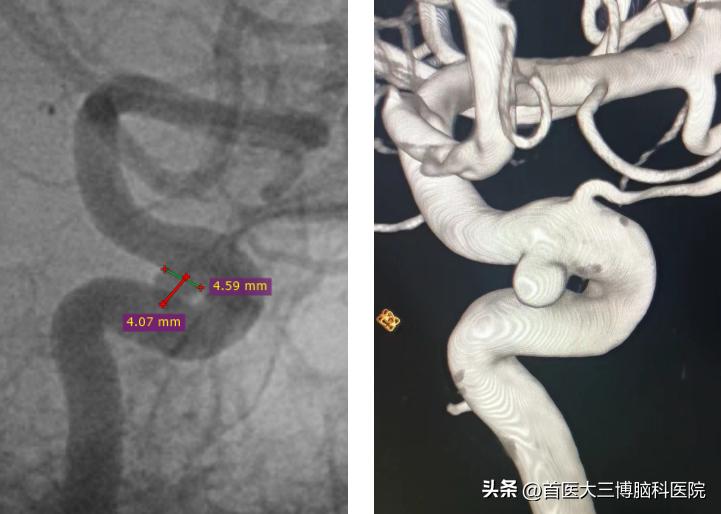 北京军区拆弹专家,北京拆弹专家