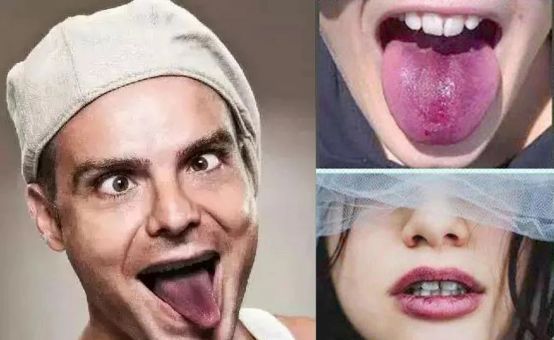 喝红酒嘴唇变色原因,为什么喝红酒舌头变色