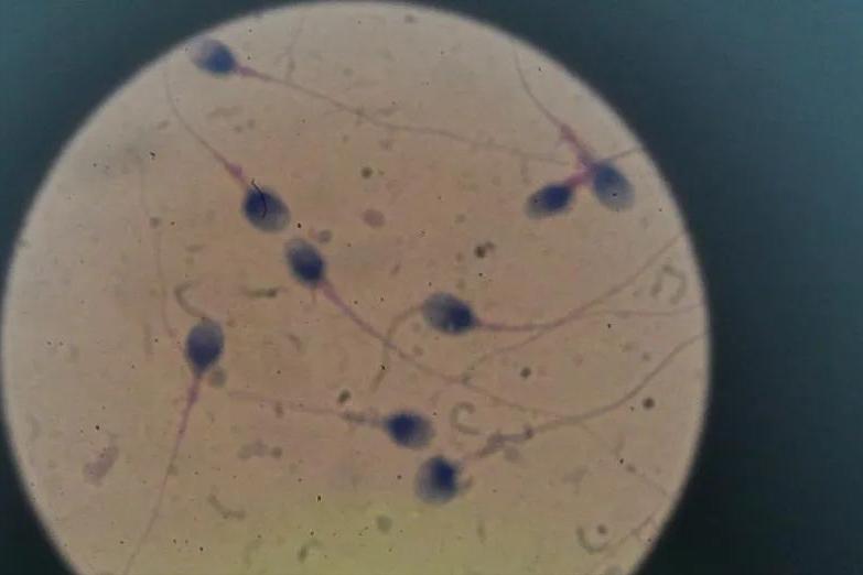 一盒安全避孕药,避孕药72小时内都有效的品名