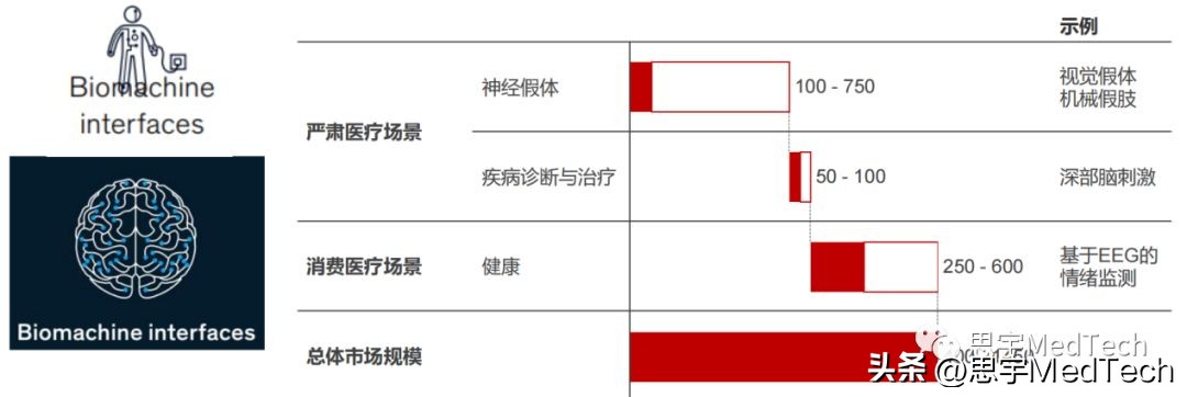 未来的脑机接口技术,全球脑机接口top20