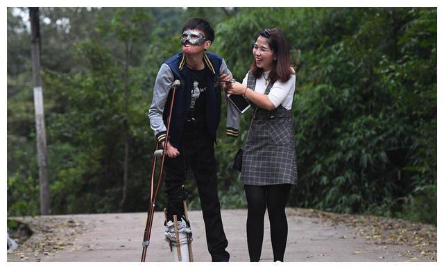 新郎救火时毁容新娘依然嫁给了他,新郎被烧伤新娘前往医院