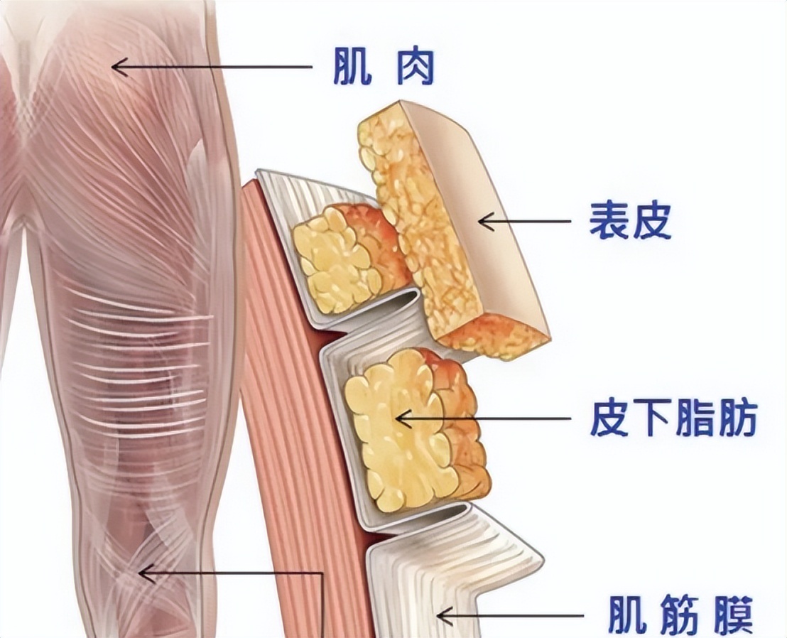 筋膜枪功效与禁忌,筋膜枪怎么用详解三大隐患缺点