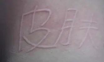 夏天孩子皮肤痒抓破皮,小孩子皮肤干燥发痒都抓出血来