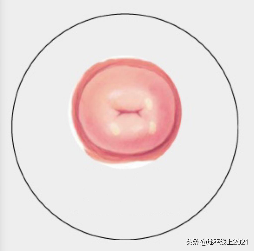 女性宫颈为啥老出问题,宫颈常见问题有哪些