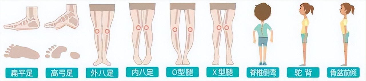 儿童身高管理高抬腿,孩子身高矮如何进行身高管理