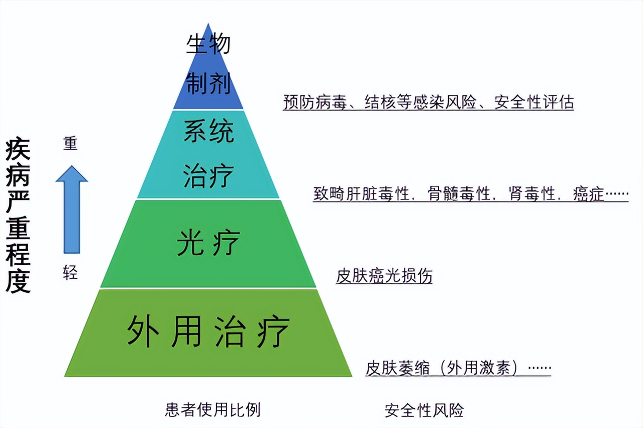 银屑病常见治疗误区中招,常见银屑病治疗误区