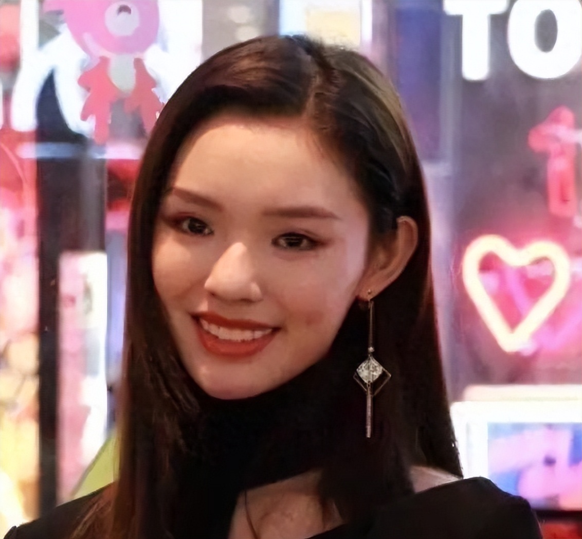 明星嘴突戴牙套前后对比,明星和假牙